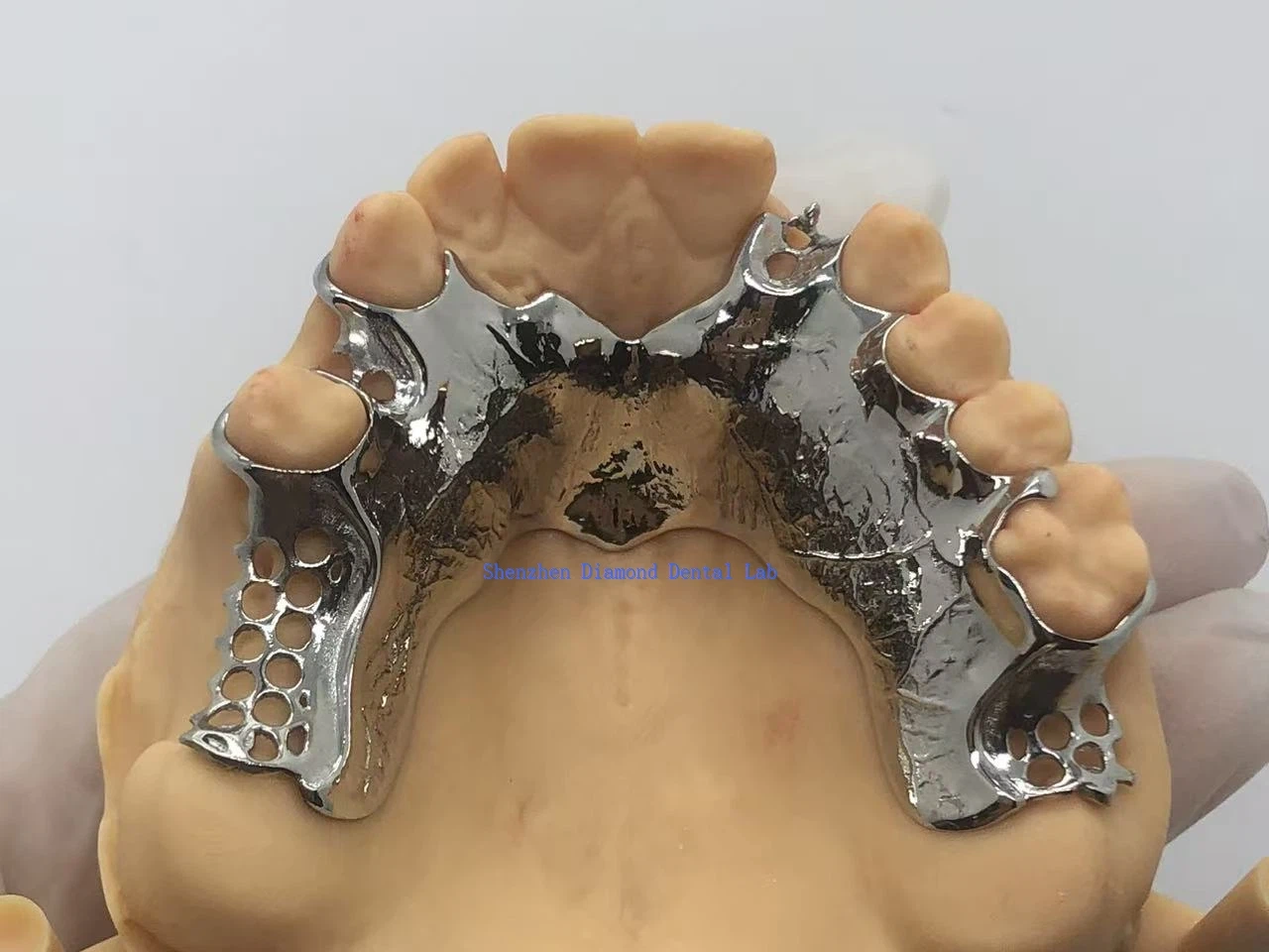 Cadru dentar din cobalt-crom metal